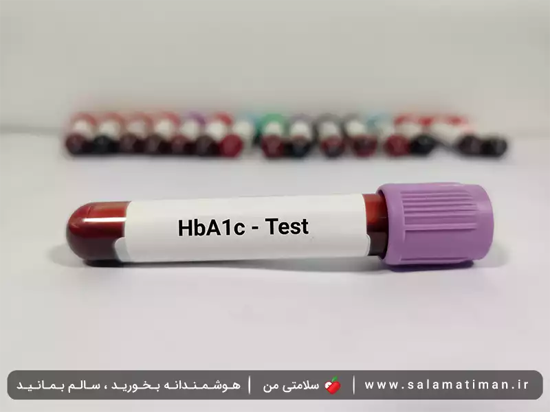 آزمایش HbA1c