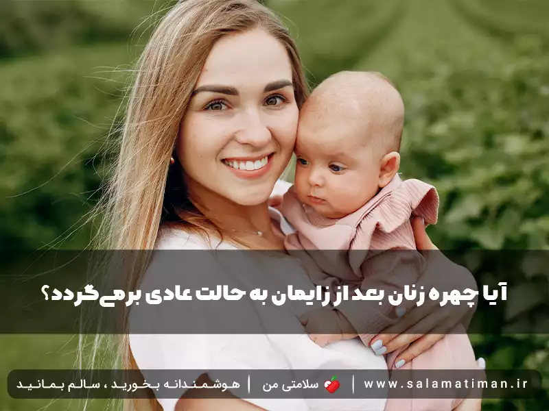 آیا چهره زنان بعد از زایمان به حالت عادی برمی‌گردد؟