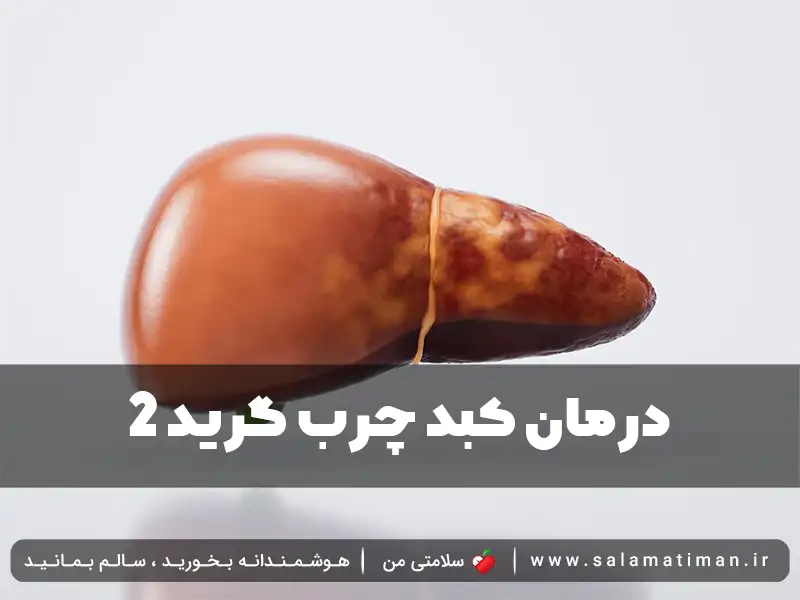 درمان کبد چرب گرید 2